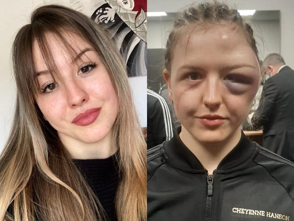 Gương mặt xinh xắn của nữ võ sĩ bị biến dạng xấu thê thảm - 1 Gương mặt xinh xắn của nữ võ sĩ bị biến dạng xấu thê thảm - 1