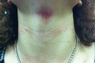 Hà Nội: Vừa đánh người, vừa chiếm nhà