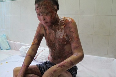 Kẻ tạt axit cả gia đình đi chữa bệnh tâm thần