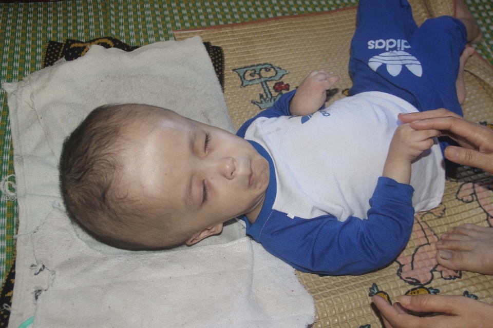 Xót xa cảnh vợ mù lòa ôm con bị não úng thủy nằm liệt giường suốt nhiều năm - 2 Xót xa cảnh vợ mù lòa ôm con bị não úng thủy nằm liệt giường suốt nhiều năm - 2