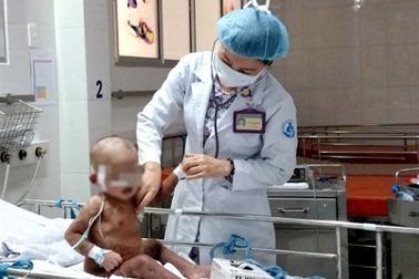 TPHCM: Cha mẹ xông hơi trị Covid-19 cho con, nhiều trẻ bỏng nặng thương tâm