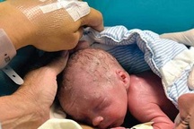 Người phụ nữ ghép tử cung đầu tiên sinh con