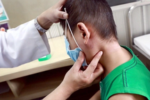 Ai có nguy cơ mắc Whitmore, dấu hiệu bệnh là gì?