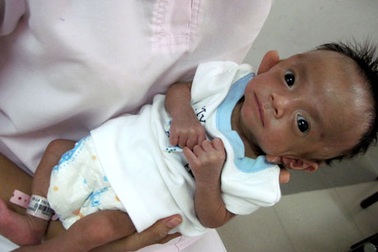 Hơn 40 triệu đồng đến với bé sinh non thoi thóp thở