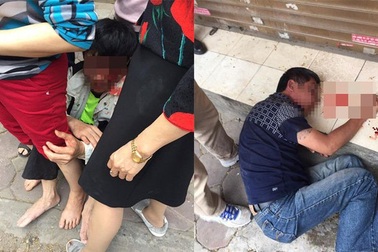 Hà Nội: 3 người bị đánh toét đầu vì nhầm trộm xe SH