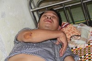 Phó trạm trưởng trạm kiểm lâm bị lâm tặc đánh nhập viện