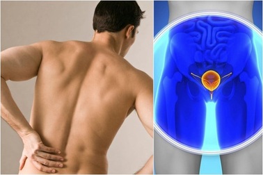 Loại ung thư ở nam giới có thể chữa khỏi nếu phát hiện sớm