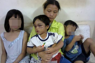 Bé trai 3 tuổi bị bạo hành: Khẩn trương tìm đưa cháu vào “nhà tạm lánh”