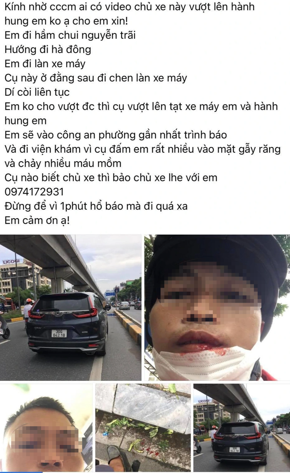 Tài xế xe ôm bị người đàn ông đi ô tô đánh vì không nhường đường? - 1 Tài xế xe ôm bị người đàn ông đi ô tô đánh vì không nhường đường? - 1