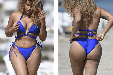 Người đẹp 24 tuổi khoe dáng sau ca phẫu thuật thẩm mỹ thứ 4