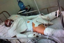 Bộ trưởng Y tế yêu cầu hỗ trợ cho điều dưỡng viên bị “thiêu sống”