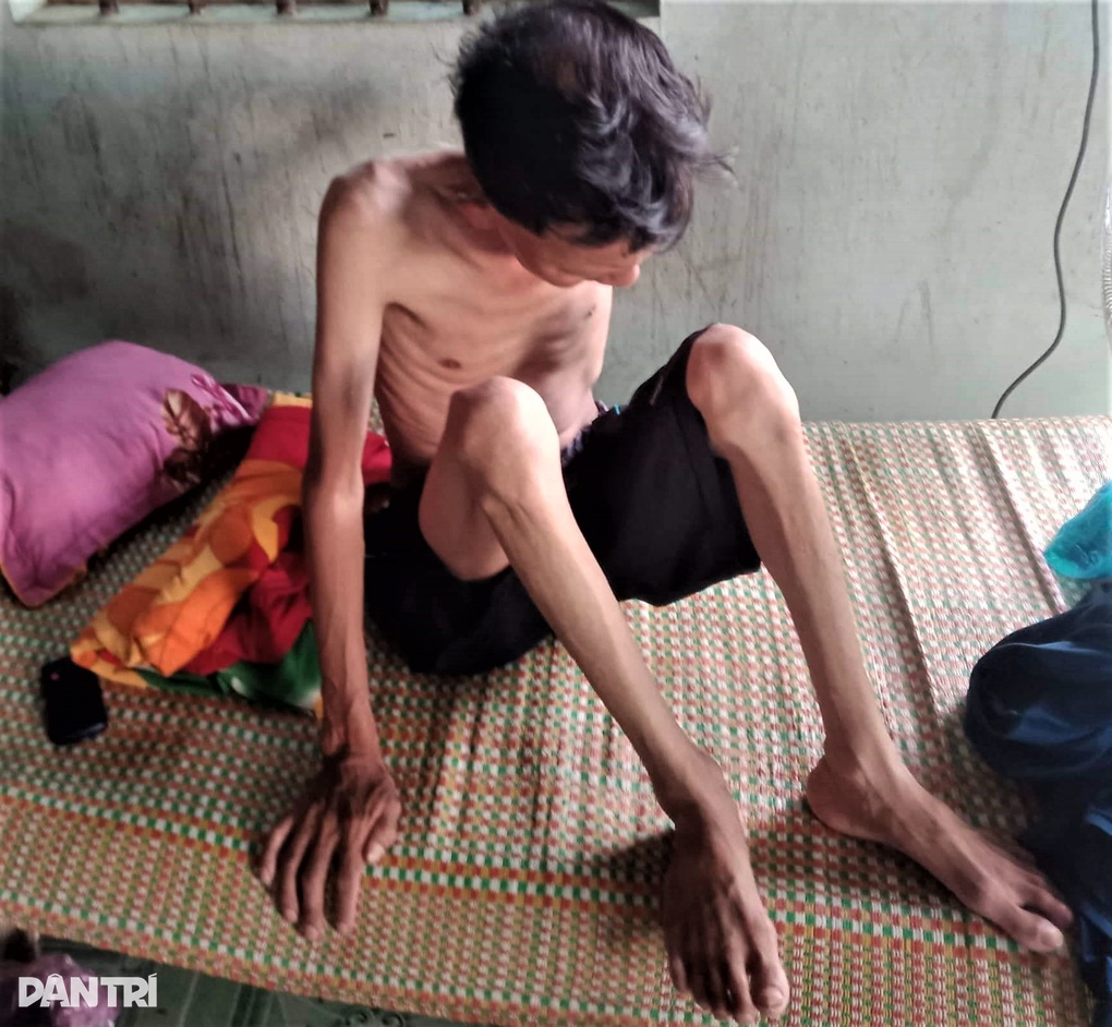 Chồng kề cận cái chết, người phụ nữ 5 con chỉ mong đủ cái ăn sống qua ngày - 3