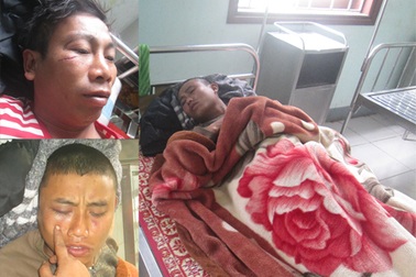 Yêu cầu làm rõ vụ việc Bí thư chi bộ thôn hành hung cử tri tại cuộc họp