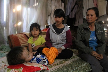 Hơn 206 triệu đồng bạn đọc giúp đỡ bé trai bị não úng thủy