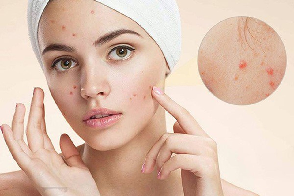 Điểm mặt 5 thủ phạm hàng đầu khiến lá gan bị nóng - 3 Điểm mặt 5 thủ phạm hàng đầu khiến lá gan bị nóng - 3