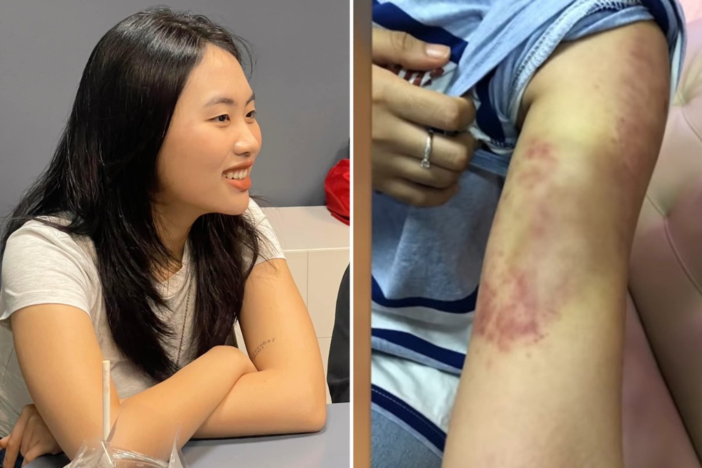 Sao Việt giảm cân sai cách: Phương Mỹ Chi bầm dập, Lan Ngọc nhập viện - 5 Sao Việt giảm cân sai cách: Phương Mỹ Chi bầm dập, Lan Ngọc nhập viện - 5