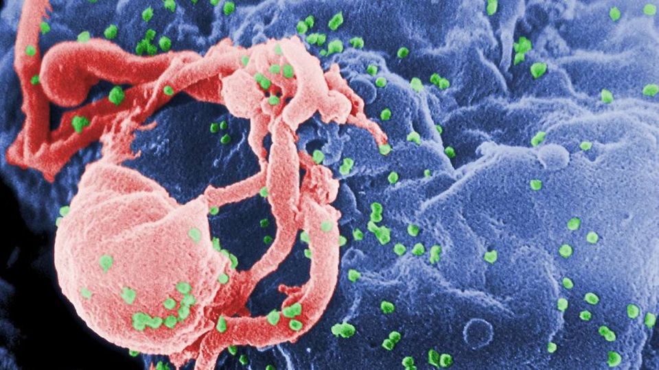Người thứ 2 trên thế giới được chữa khỏi HIV - 1 Người thứ 2 trên thế giới được chữa khỏi HIV - 1