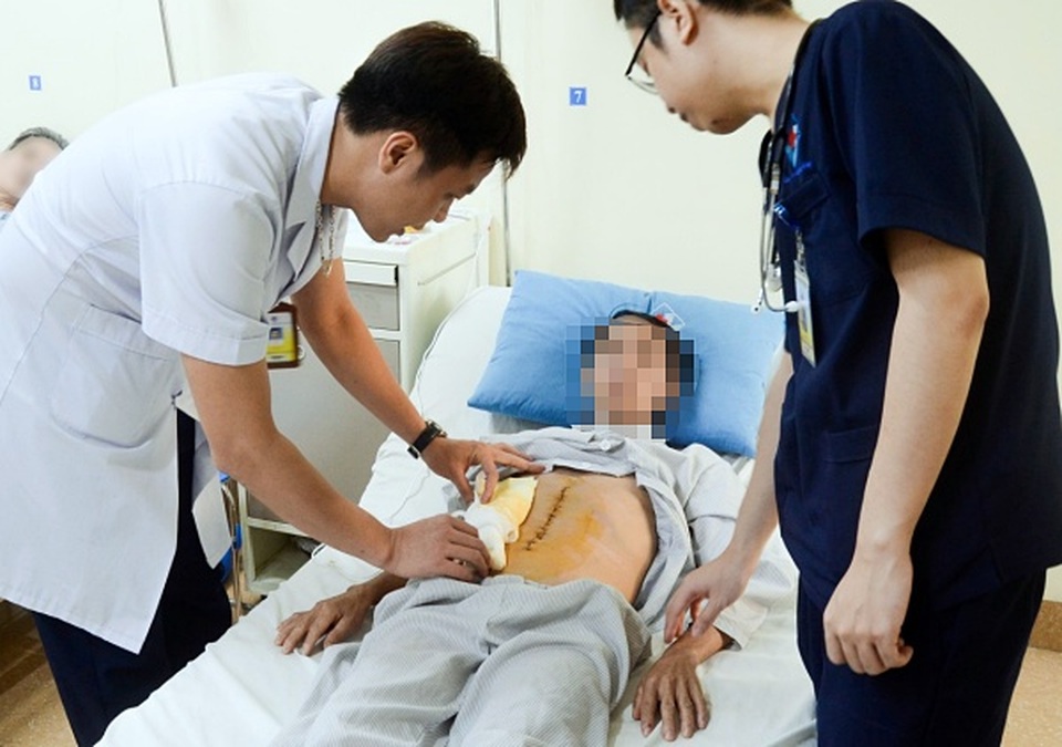 Đi khám vì đau bụng, ăn chậm tiêu, người đàn ông phát hiện mắc ung thư hiếm - 2 Đi khám vì đau bụng, ăn chậm tiêu, người đàn ông phát hiện mắc ung thư hiếm - 2