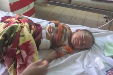 Đốt rác có mìn, 2 cha con nhập viện