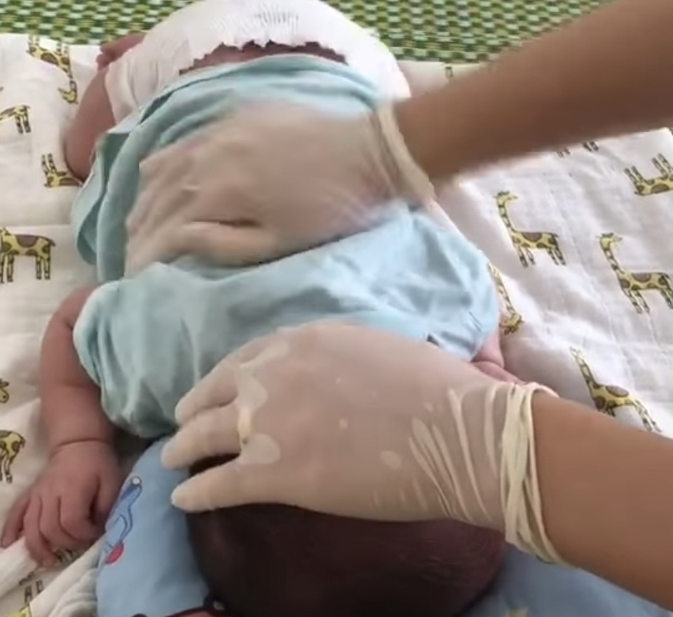 Tranh cãi clip bé sơ sinh bị vỗ lưng “bồm bộp” - 1 Tranh cãi clip bé sơ sinh bị vỗ lưng “bồm bộp” - 1