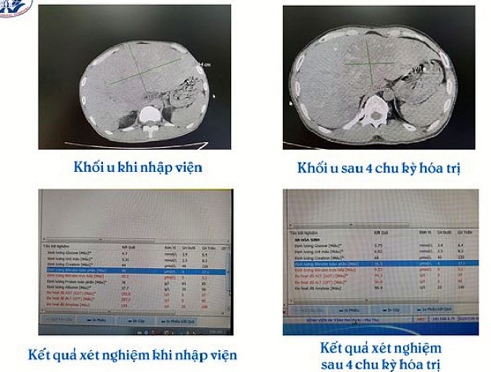 39 tuổi, người đàn ông bàng hoàng nhận “phán quyết” ung thư giai đoạn cuối - 2