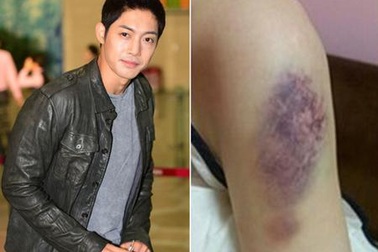 Bạn gái cũ của Kim Hyun Joong đã sinh con