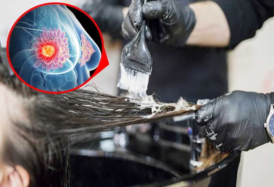 Thuốc nhuộm tóc, duỗi tóc làm tăng nguy cơ mắc ung thư vú - 1 Thuốc nhuộm tóc, duỗi tóc làm tăng nguy cơ mắc ung thư vú - 1