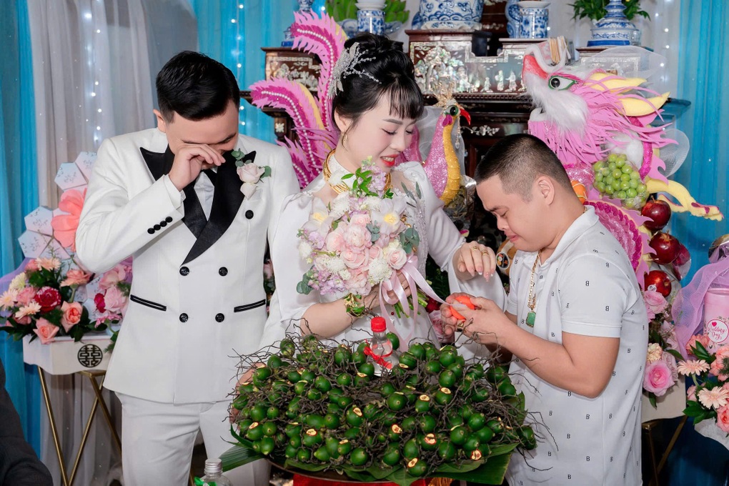 Anh bị Down tặng em gái 1 chỉ vàng ngày cưới khiến nhiều người rơi nước mắt - 1 Anh bị Down tặng em gái 1 chỉ vàng ngày cưới khiến nhiều người rơi nước mắt - 1