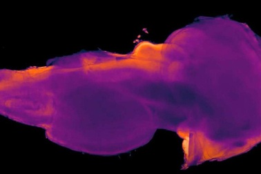Khu vực bí ẩn trong bộ não người lần đầu được biết đến