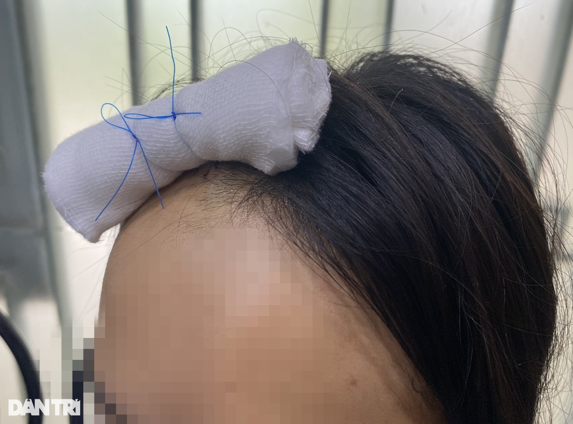 Đêm giao thừa kinh hoàng của cô gái bị đánh dã man vì mời bia không uống - 2 Đêm giao thừa kinh hoàng của cô gái bị đánh dã man vì mời bia không uống - 2