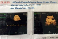 Bắt khẩn cấp bảo vệ trường học nghi xâm hại khiến nữ sinh lớp 6 mang thai