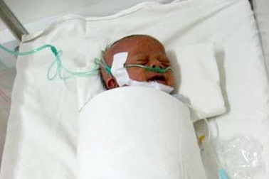 Bé Yưn được theo dõi đặc biệt tại BV Nhi Đồng 1