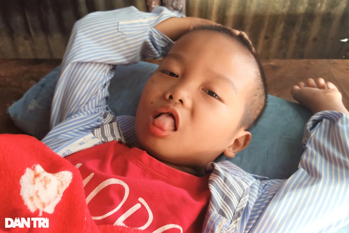 Cha bỏ đi, 2 con câm ở với mẹ khờ thiếu ăn, khát sữa, mong được chữa bệnh - 3 Cha bỏ đi, 2 con câm ở với mẹ khờ thiếu ăn, khát sữa, mong được chữa bệnh - 3