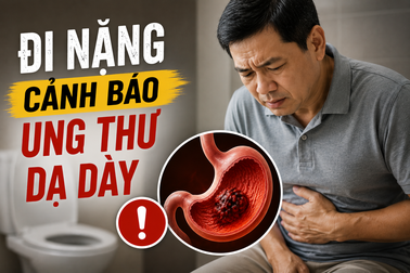 Dấu hiệu cảnh báo ung thư dạ dày khi đi vệ sinh