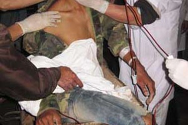 Nát chân vì bị cuốn vào máy xay đất làm gạch