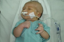 Ca phẫu thuật giành sự sống cho bé Nhân Hòa đã thành công