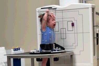 Khoảnh khắc em bé chụp X-quang gây bão mạng