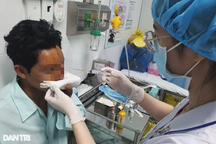 Người đàn ông 33 tuổi bị bạn nhậu cắn đứt mũi