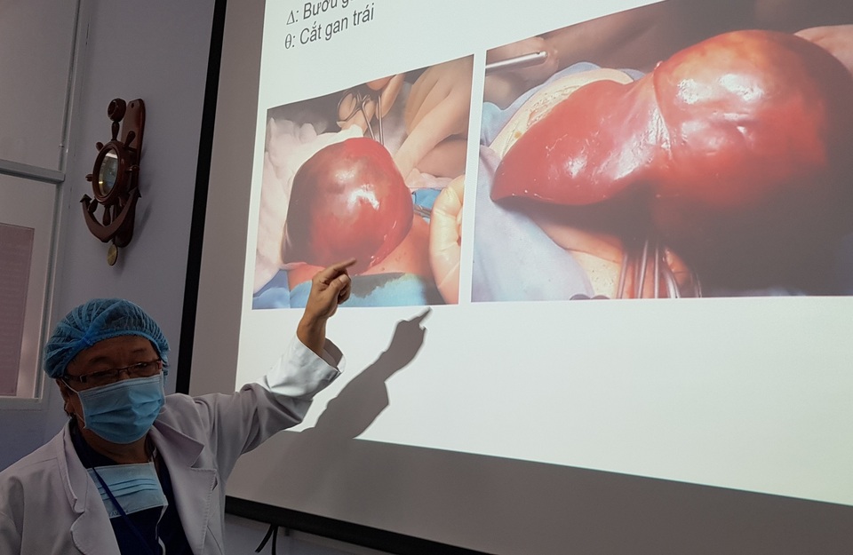 Vàng da sơ sinh ở trẻ, coi chừng bệnh lý nguy hiểm - 3 Vàng da sơ sinh ở trẻ, coi chừng bệnh lý nguy hiểm - 3