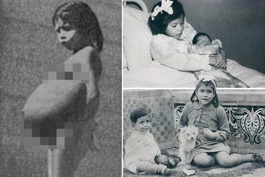 Bé gái 5 tuổi mang thai 7 tháng, trở thành bà mẹ trẻ nhất thế giới