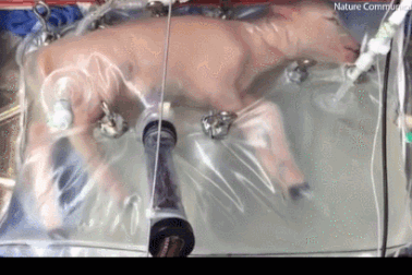 Sẽ có những em bé chào đời từ "túi nhựa"?