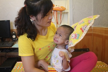 Mong manh sự sống của bé 2 tuổi 3 lần mổ não