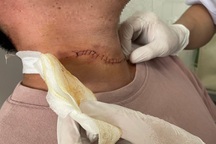 Lời khai của nghi phạm cứa cổ, vòi tiền người đi tắm biển ở Phú Quốc