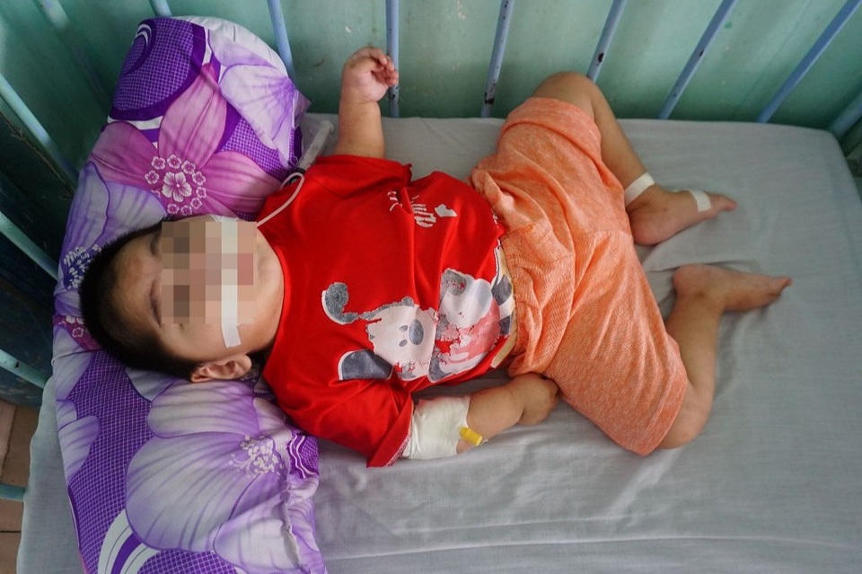 Người phụ nữ có 20 năm làm mẹ của những trẻ em khuyết tật - 3 Người phụ nữ có 20 năm làm mẹ của những trẻ em khuyết tật - 3