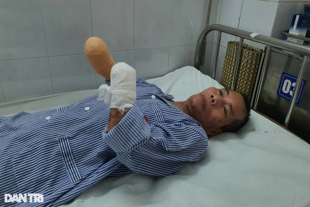 Người đàn ông mất đôi tay, chân phải tàn phế vì bỏng điện cao thế - 2