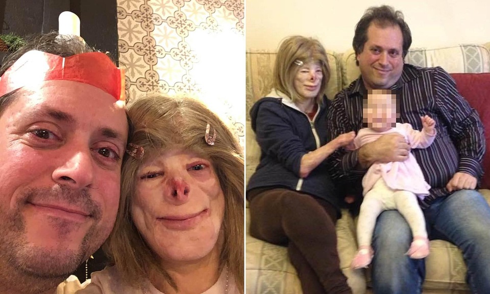 Hạnh phúc bất ngờ của cô gái từng bị bỏng đến biến dạng - 7