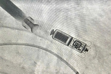 Thiết bị nhỏ bằng viên thuốc con nhộng giúp cụ bà 83 tuổi thoát đột tử