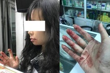 Hà Nội: Lái xe Uber đánh nữ hành khách chảy máu mồm