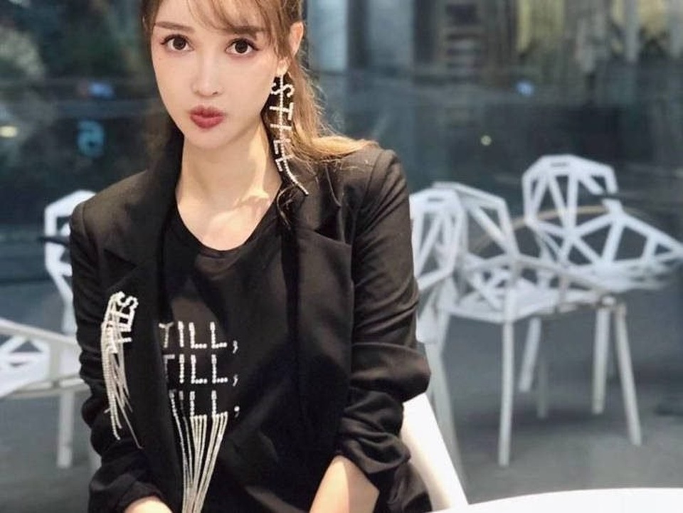 Phẫu thuật hàng trăm lần từ khi 16 tuổi để luôn có vẻ ngoài hoàn hảo - 7 Phẫu thuật hàng trăm lần từ khi 16 tuổi để luôn có vẻ ngoài hoàn hảo - 7