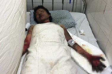 Nữ nạn nhân vụ cháy nổ trong nhà trọ không người thân chăm sóc